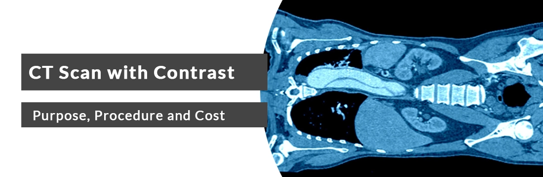 Ct Scan With Contrast Purpose Procedure And Cost